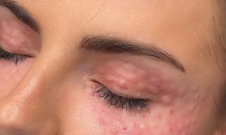 1 session polynucleotide and 1 session skin booster  - Venus Clinic