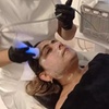 Image 1: Hidrolimpieza facial con radiofrecuencia y electroestimulación 
