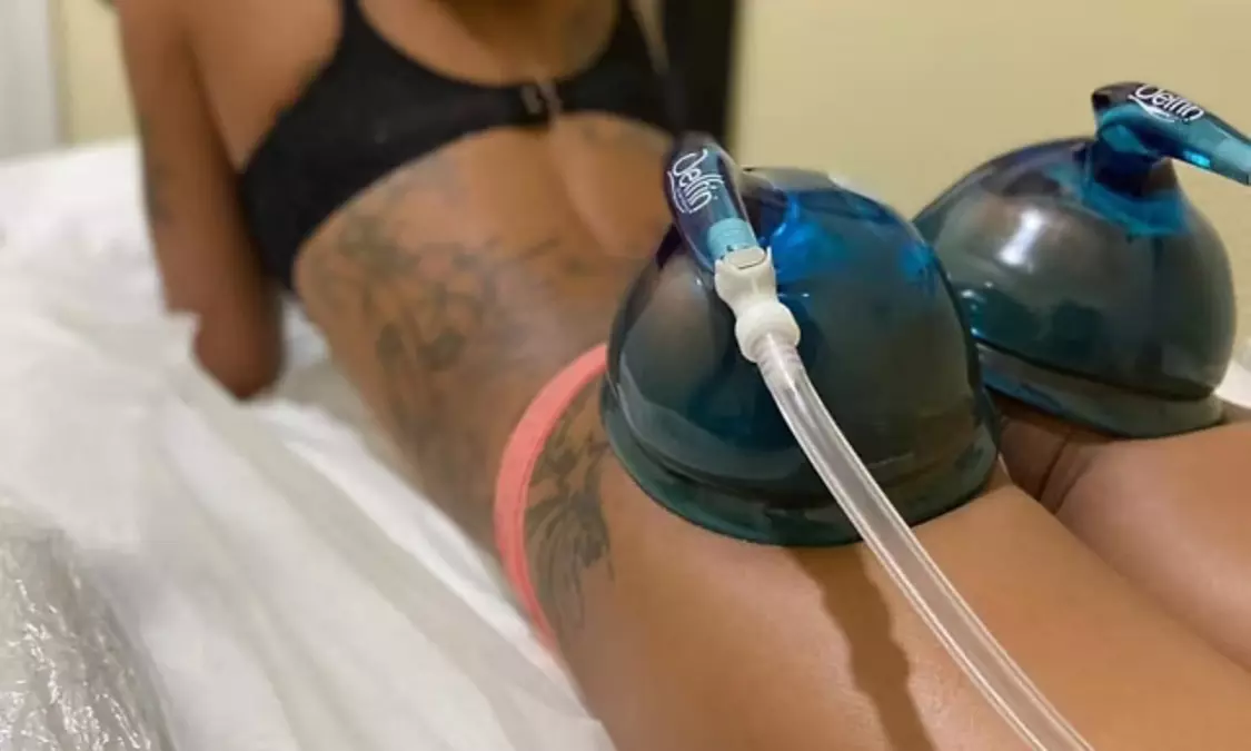 Up to 30% Off on Non-Surgical Butt Lift at Aesthetic Luxe spa