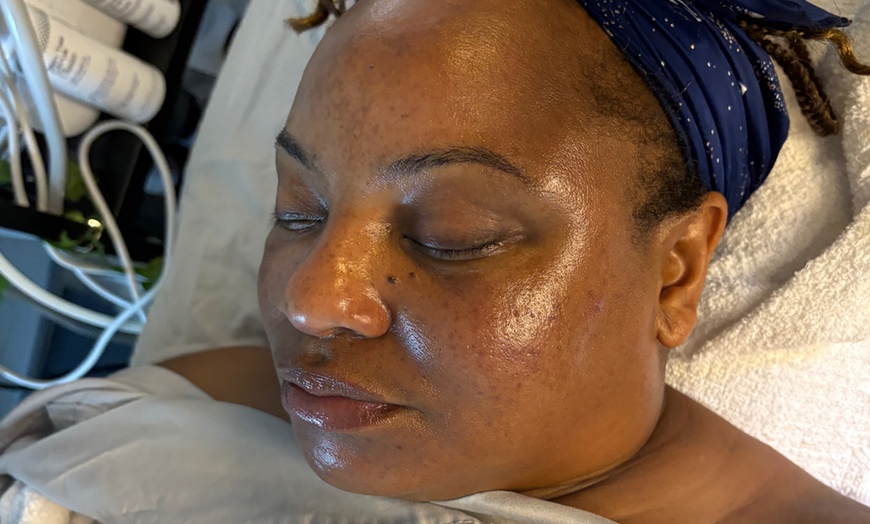 Image 1: 60-Min Treá Luxe Back Treatment or 65-Min Luminous Facial Package