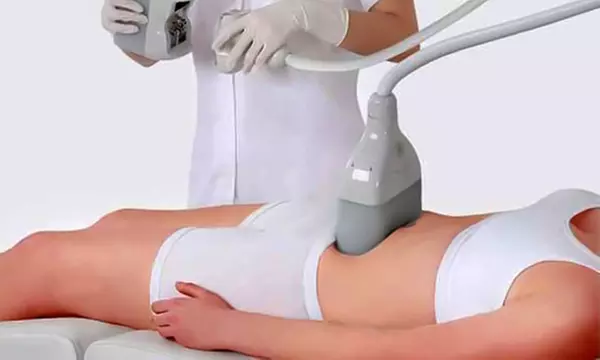 Séances de cryolipolyse ciblées sur 1 ou 2 zones