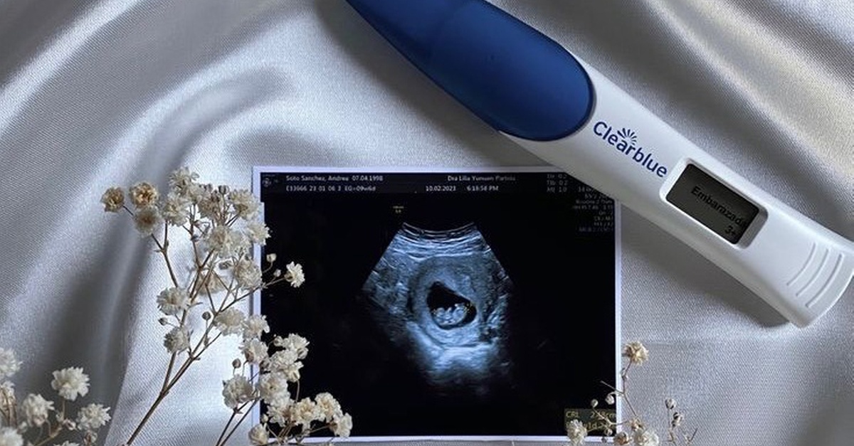 Ecografía 5D prenatal en Madrid