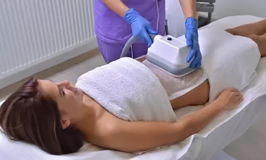 Image 1: Pour une silhouette redessinée : cryolipolyse avec Smart Body