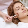 Image 2: VI Chemical Peel: Erase Sun Damage, Fade Pigmentation