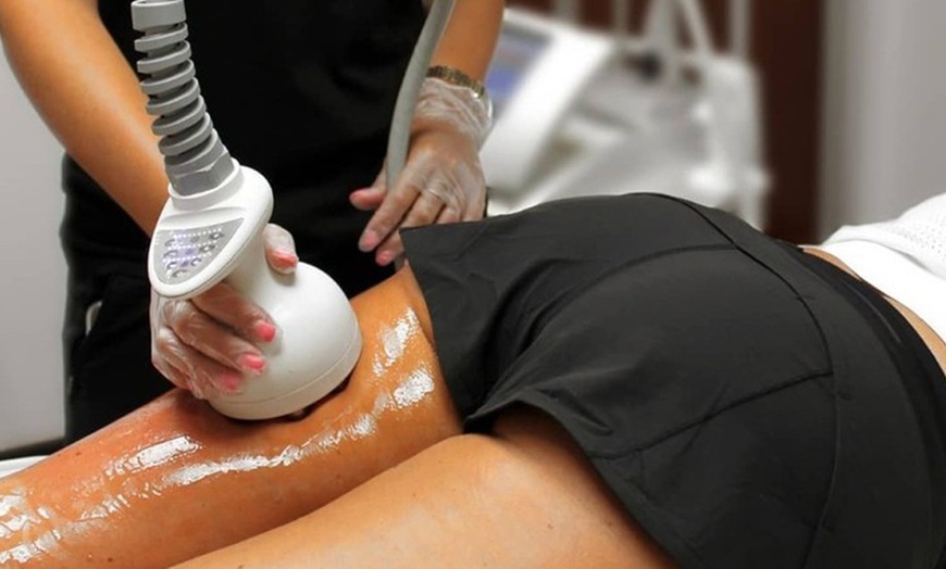 Image 8: One or Three Venus Legacy RF Skin Tightening Treatments