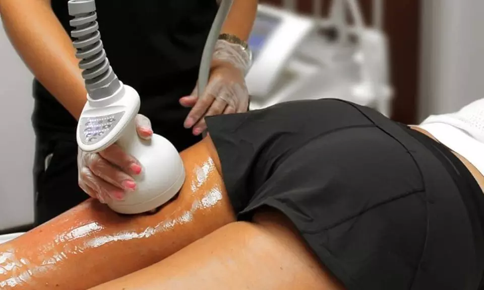 One or Three Venus Legacy RF Skin Tightening Treatments