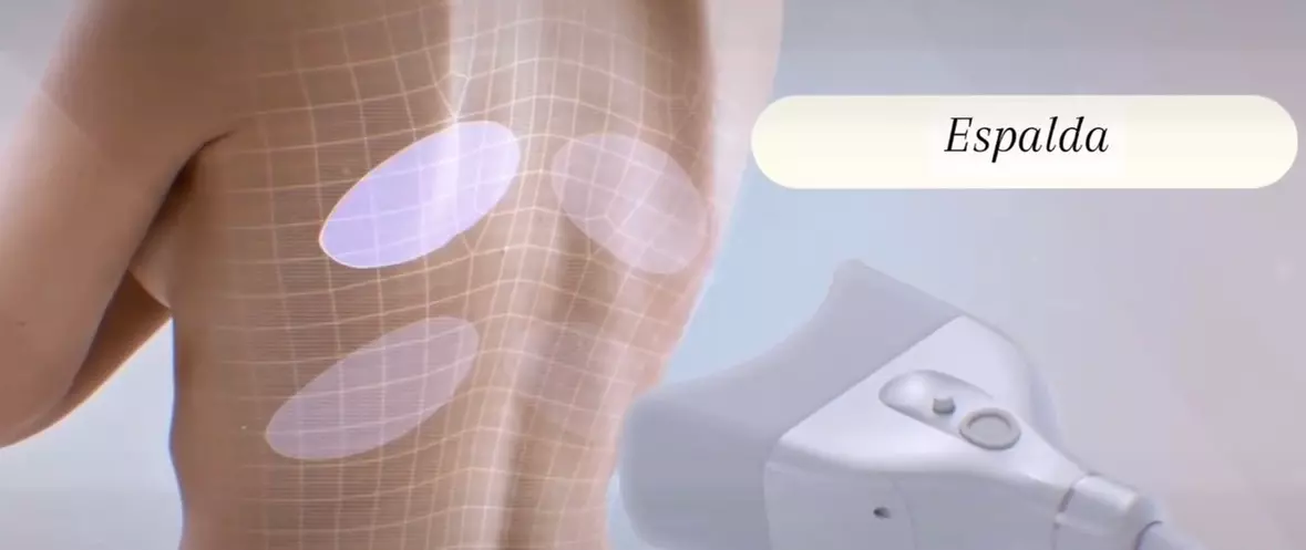 Recupera tu figura con sesiones de criolipólisis con presoterapia