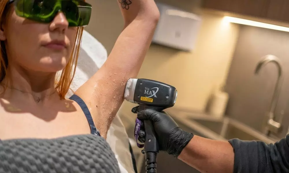 Soprano ICE Titanium Laser Hair Removal on Small, Medium or Large Area