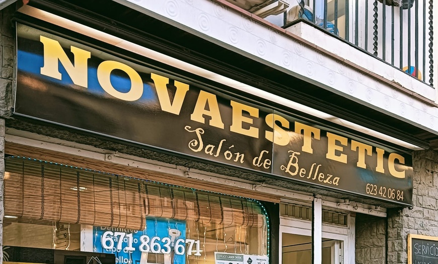 Image 4: Fotorejuvenecimiento facial y eliminación de manchas con laser IPL