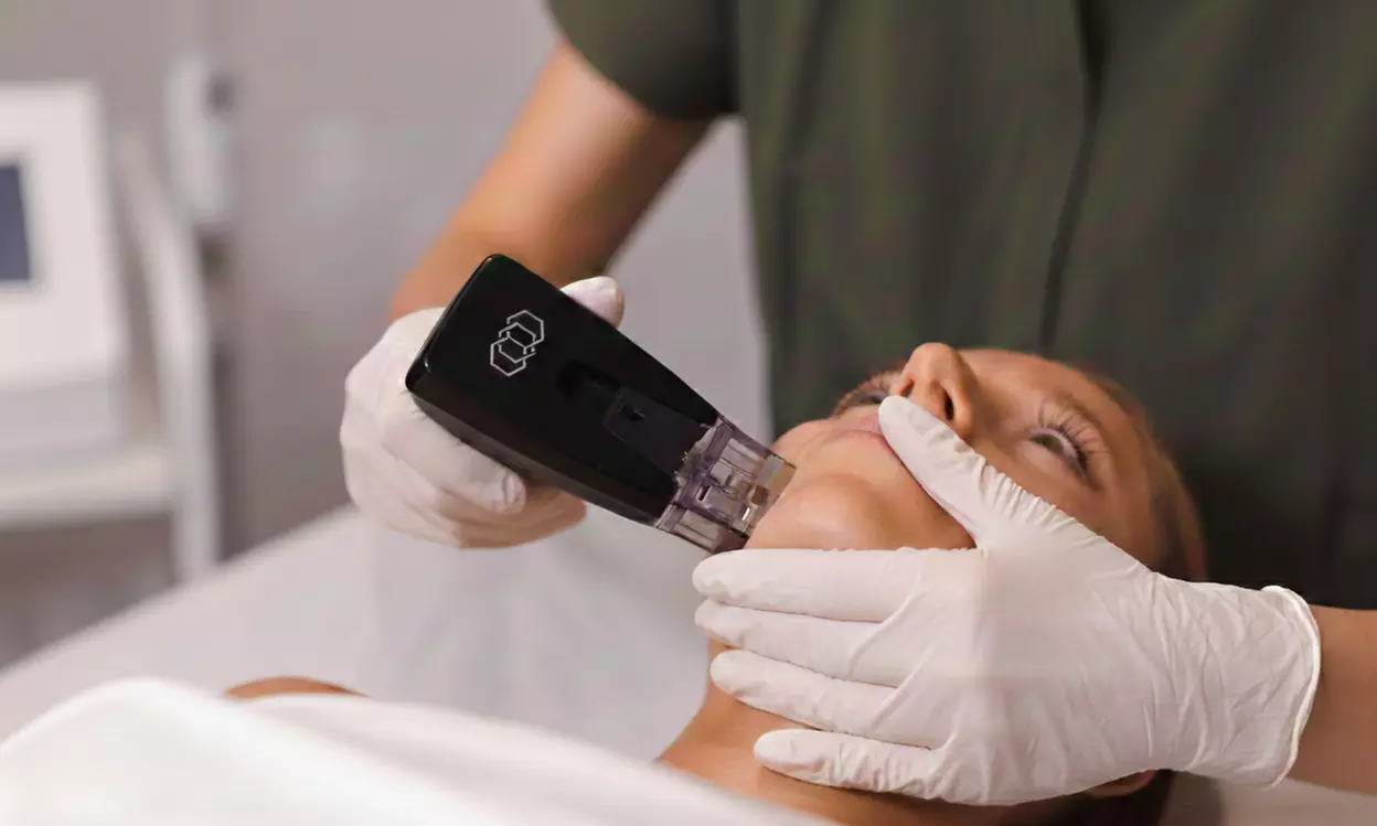 1 o 2 sesiones de Morpheus8 en zona a elegir