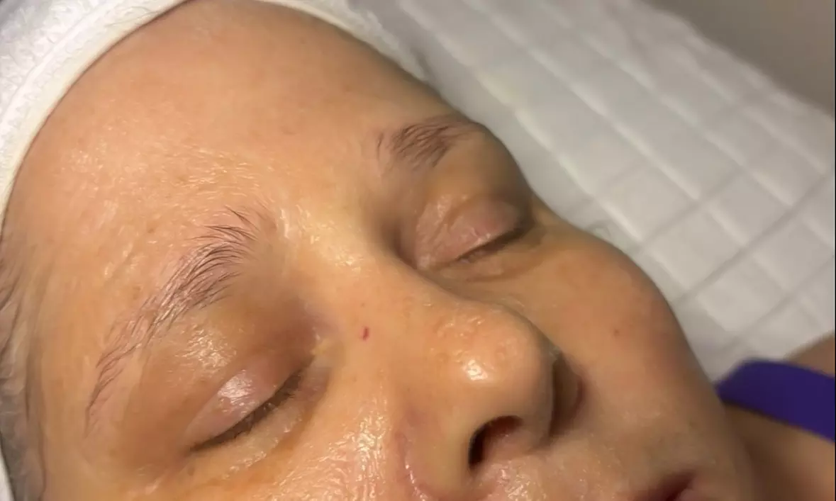 Up to 53% Off on Anti-Aging Facial at KP Aesthetics - Second Medium