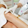 Image 1: 6 Laser Hair Removal Sessions One Small, Medium, or Large Area