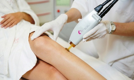 6 Laser Hair Removal Sessions on One Small Area - Delicate Laser