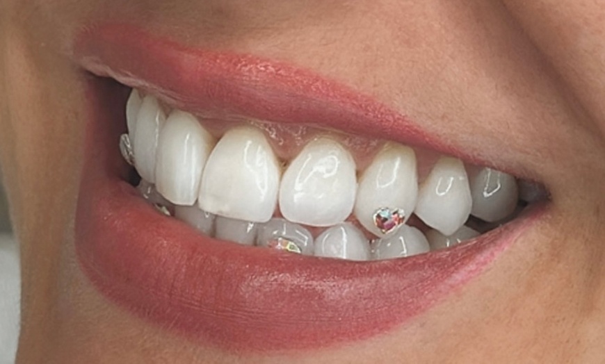 Image 1: Joyas dentales y revisión