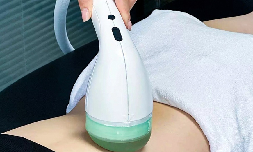 Image 2: One Shockwave Therapy Session for 1 or 2 Areas w/ Consultation & Exam