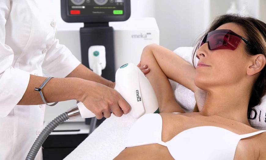 Image 4: Hasta 7 sesiones de depilación láser unisex 