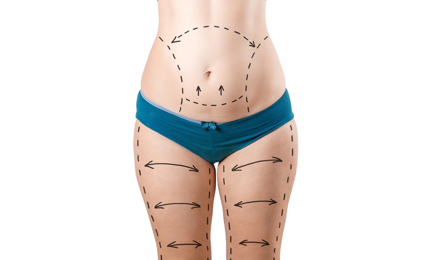 Image 4: Relax with Relaxation/Pre/Post Natal or Lymphatic Drainage Massage
