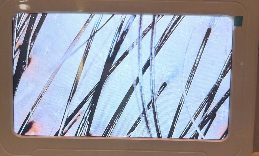 Image 5: Luxury Head Spa Treatments w/Massage on Upper-Back & Scalp for 1 or 2