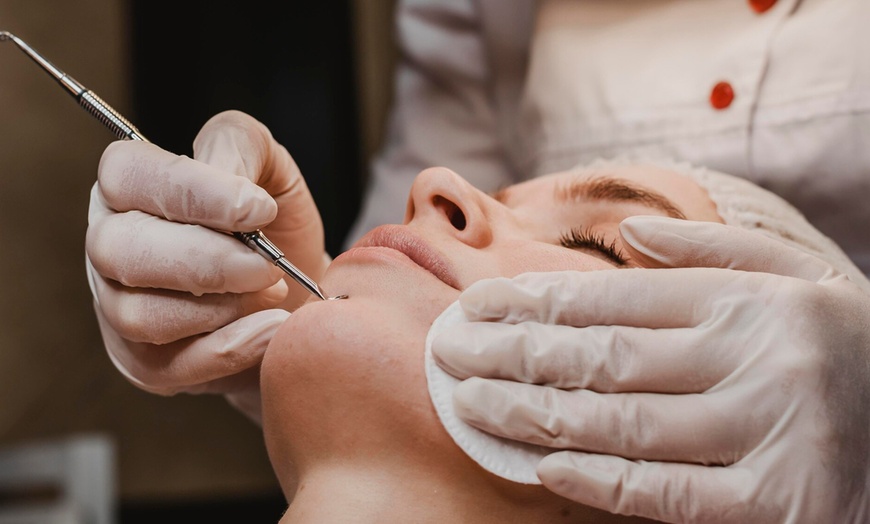 Image 5: Limpieza facial básica o profunda con opción a diferentes tratamientos
