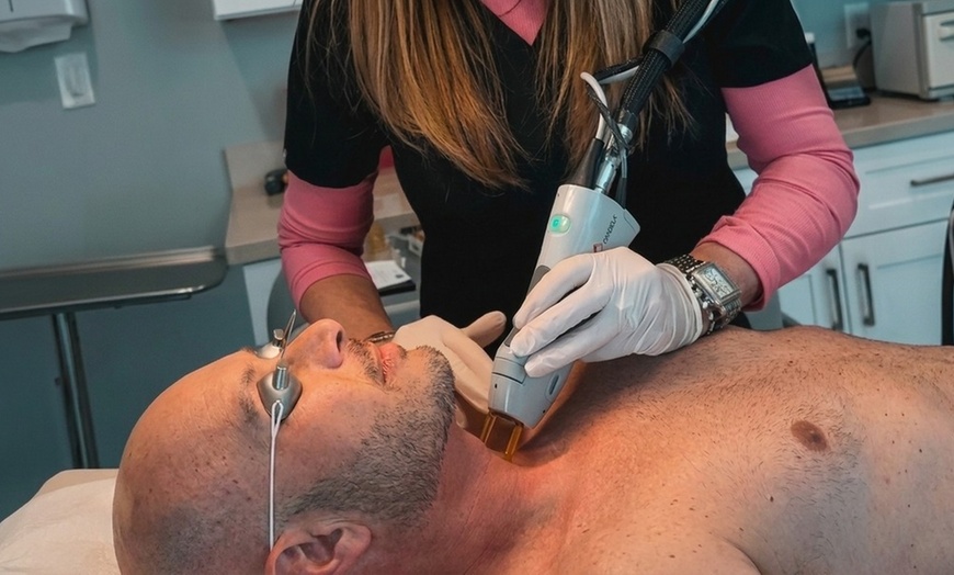 Image 9: Smooth Skin: 6 Laser Hair Removal Sessions with Candela GentleMax Pro