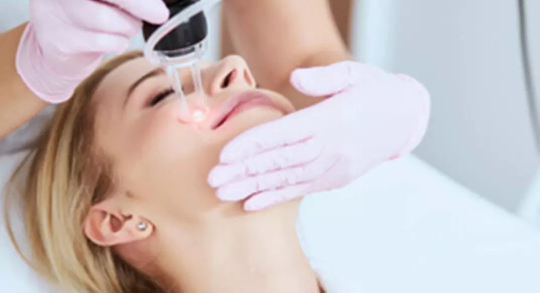 CO2 Laser Skin Renewal for Face & Neck: Smoother, Firmer, Radiant Skin