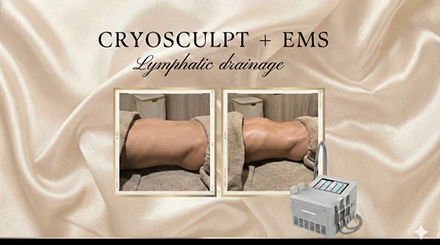Cryosculpt with EMS and Lymphatic Massage Treatment (3 in 1); 1 Session, 1hr - Sparkle Aesthetics And Beauty