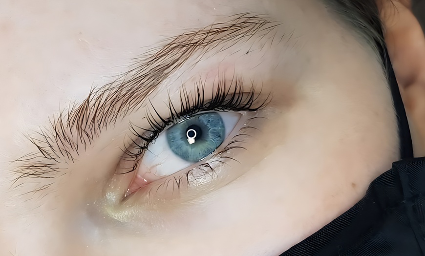 Image 2: Verzorg je huid intensief: gezichtsbehandeling of microneedling