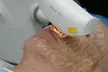 One IPL Photofacial Treatment at Total Med Solutions (Up to 46% Off)  - Second Medium