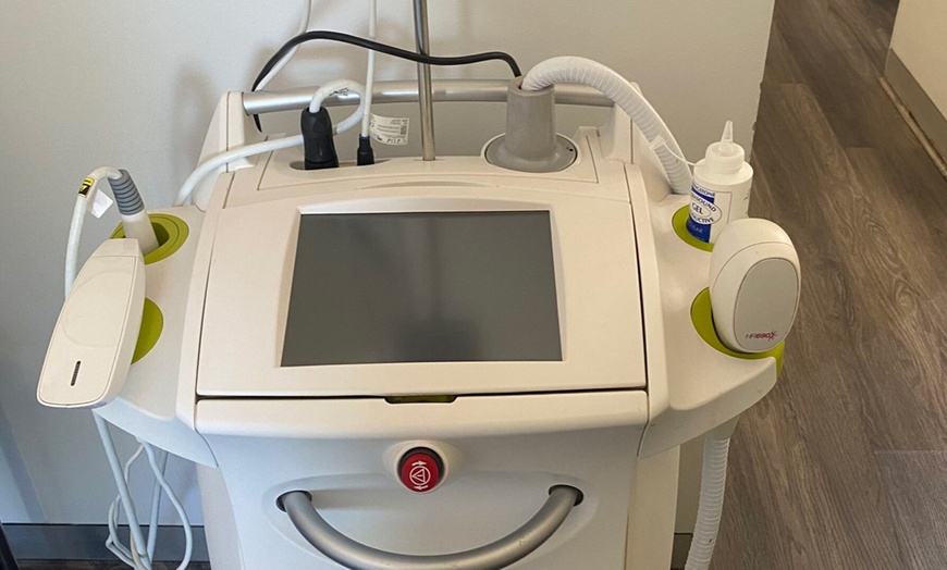 Image 6: 6 Laser Hair Removal Sessions for Every Area Size – Smooth Skin Awaits