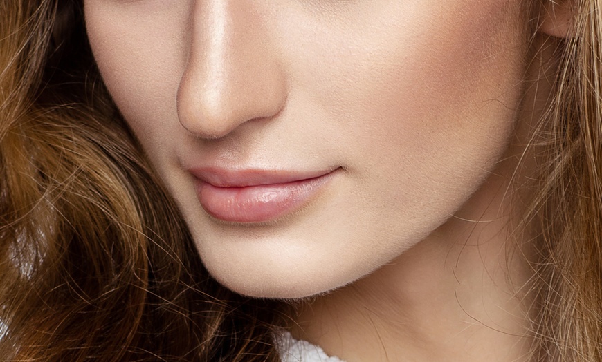 Image 1: Get Plumper Lips with 1ml Lip Dermal Filler 
