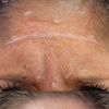Image 2: Turn Back Time w/ 20, or 40 Units of Botox