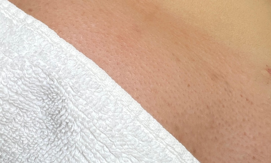 Image 4: Brazilian and Underarm Waxing