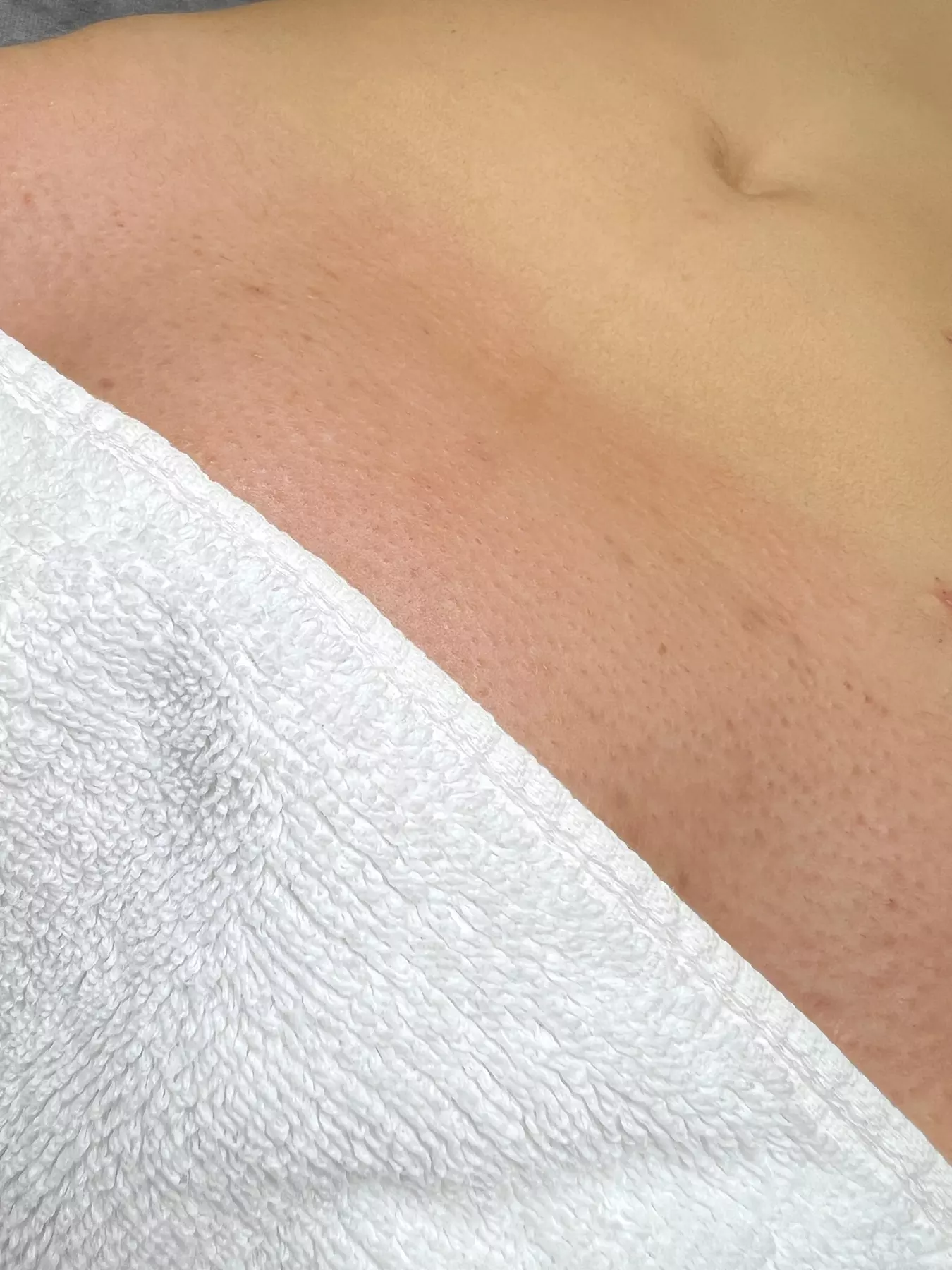 Brazilian and Underarm Waxing