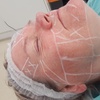 Image 2: Lift and Tone with Advanced HIFU for Face With or Without Neck