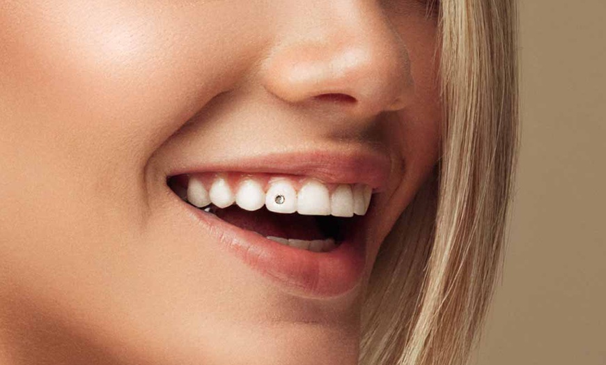 Image 4: Joyas dentales y revisión