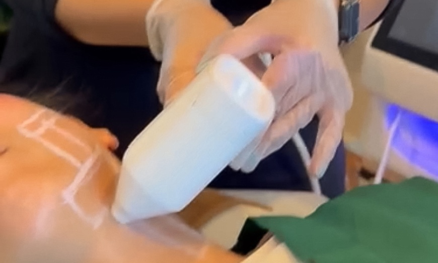 Image 1: 14D HIFU on Full Face, Neck, Declotage, or Jawline Contouring at Advanced Dermal Institute (Up to 51% Off)