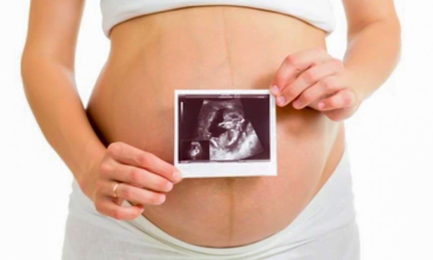 Image 1: Up to 34% Off on Ultrasound - 3D / 4D at Numi Scan Brentwood