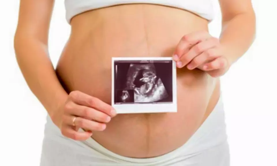 Up to 34% Off on Ultrasound - 3D / 4D at Numi Scan Brentwood - Primary Image