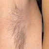 Image 2: Underarm & Upper Lip Waxing for Smooth, Refreshed Skin