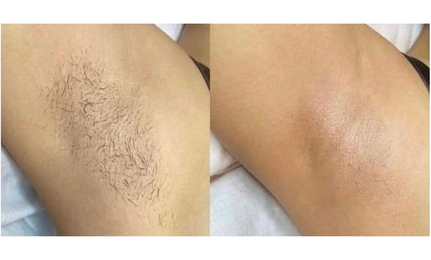 Image 2: Get a Full Body Wax or Underarms, Lower Legs and Brazilian Wax