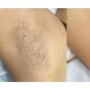Image 2: Get a Full Body Wax or Underarms, Lower Legs and Brazilian Wax