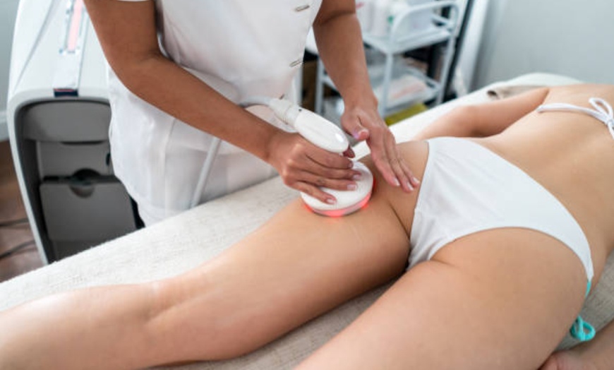 Image 10: 1, 2 o 4 sesiones de radiofrecuencia facial o corporal con masaje