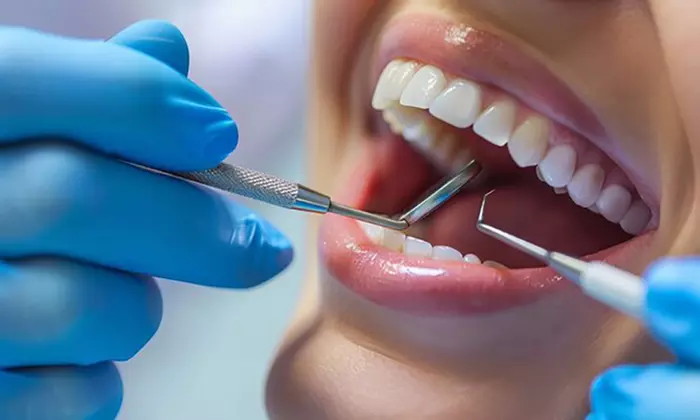 Up to 56% Off on  at AJ Dental Surgery