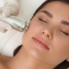 Image 2: Limpieza facial con microdermoabrasión, radiofrecuencia y vitaminas