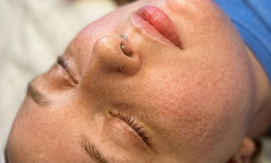 Image 6: One, Two, Three or Four Professional Grade Pro Chemical Peels