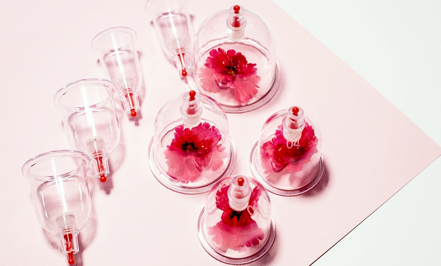 Image 5: Acupuncture with Cupping, Community Sessions or LED Red Light Options