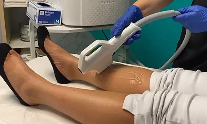 Unveil Confidence: Stunning Results from Laser Hair Removal