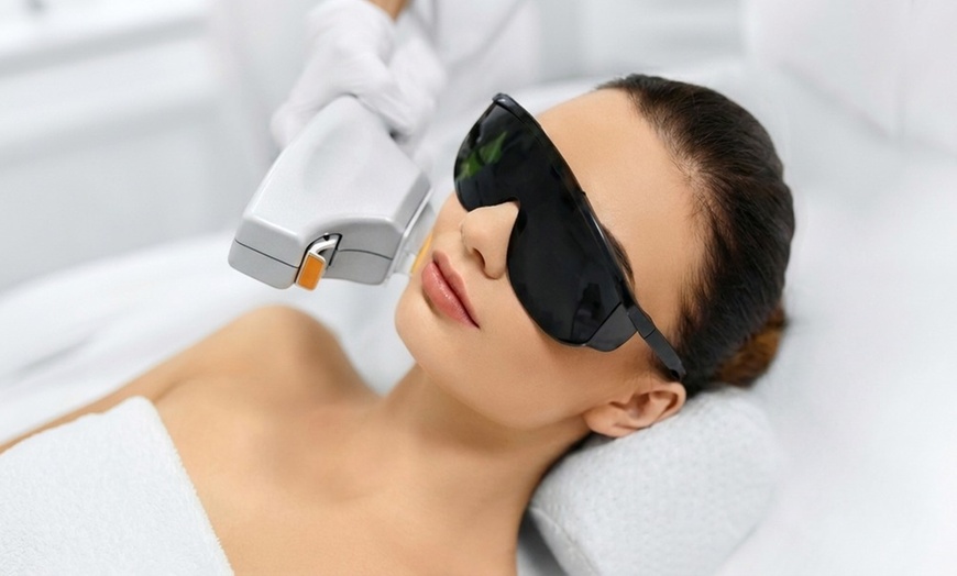 Image 2: Six IPL Laser Hair Removal Sessions for Multiple Treatment Areas