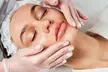 DiamondGlow Facial or Microdermabrasion and Light Peel Combo Treatment with Spa Bella Medispa (Up to 51% Off) - Second Medium