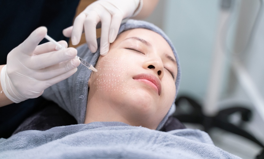 Image 2: 1, 2, or 3 Full Face & Neck Profound RF Microneedling + Rejuran Healer
